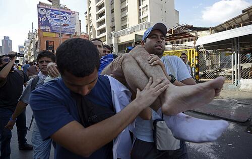 Herido en el centro de Caracas la tarde de hoy luego del ataque de los colectivos armados Chavistas #FOTO >>>>>>