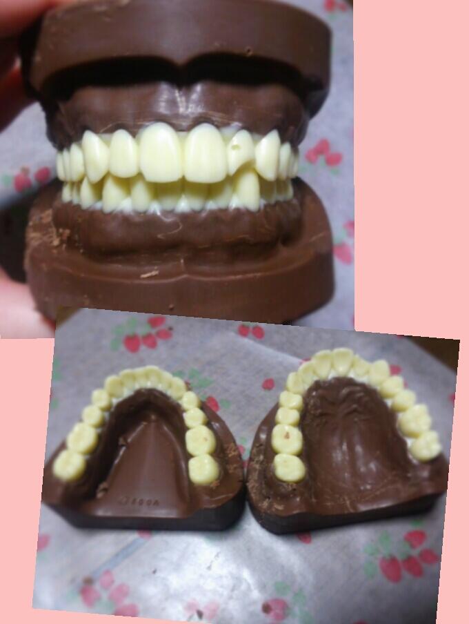 松本 明日はバレンタインなのでチョコを作りました 歯科系の学校に通ってるので入れ歯チョコです 上顎下顎両方だぜ 家族からは大不評でした 明日学校に持っていくからみんな残さず食えよ Http T Co Lboncb4stj 松本 明日はバレンタインなのでチョコを作りました 歯科系の学校に通ってるので入れ歯チョコです 上顎下顎両方だぜ 家族からは大不評でした 明日学校に持っていくからみんな残さず食えよ Http T Co Lboncb4stj
