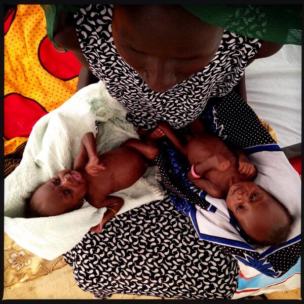 mgoldfarb71's tweet photo. Malnourished twins held by aunt @  #MSF clinic in #Juba . Mom died 2 days post birth. All = IDPs. #SouthSudanCrisis http://t.co/0DUndTk9P7