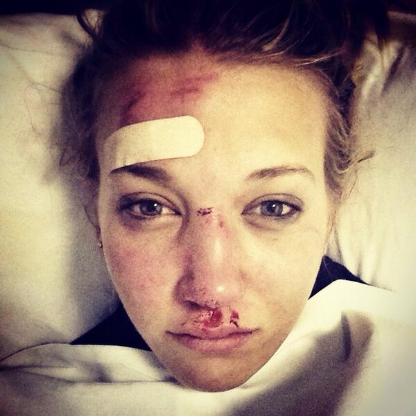 British Olympian's Selfie Shows What Happens When You Mess Up at Skiing Bgp8D9EIMAAvx3I