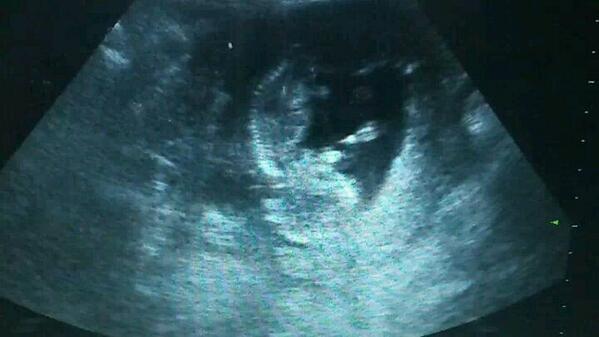 mesonelpilar's tweet photo. Primera foto d mi niet@ Oleeeeeeeeee http://t.co/xCGOqJPwbX