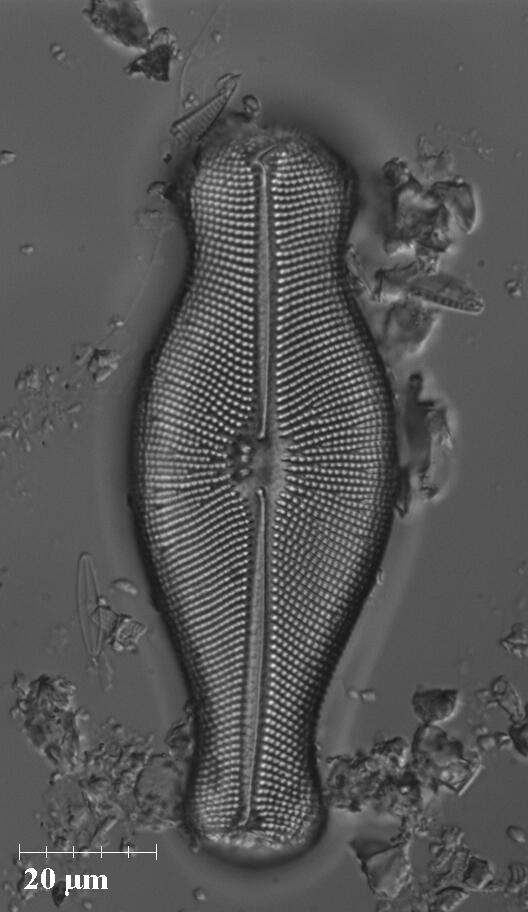 drtightline's tweet photo. "Snot" introduced: New info http://t.co/fNEkCtGVT4 on only diatom #didymo ever in NYT OP-ED http://t.co/oDogeNG329 http://t.co/tdnJsNj8yZ