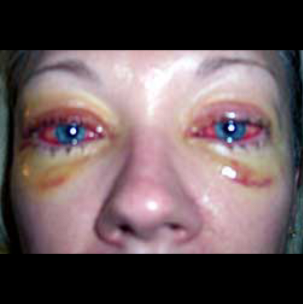 BurrellEddy's tweet photo. Retweet this in 15 seconds or you'll have this around your eyes http://t.co/Txmd10r5Cd