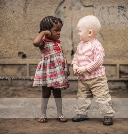 Chrispatine's tweet photo. White/Ebony, un reportage #photo signé @PatriciaWillocq Intégration et beauté #albinos en #RDC http://t.co/yPnkm3ofmx http://t.co/ChgqotajnE