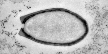 nazarethmarshal's tweet photo. Gilaa "@kompascom: Sebuah Virus "Bangun" Setelah "Tidur" Selama 30.000 Tahun http://t.co/2gnsHQFfWh http://t.co/ZyH58erh1X"
