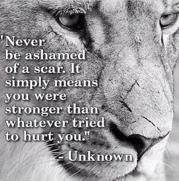 ATBFootball's tweet photo. "Scars remind us of where we've been. They don't have to dictate where we are going." http://t.co/qPiJwEW6hM