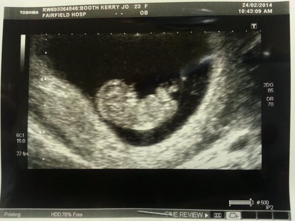 #boy #babyhyland haha.  Was amazing wasnt it bbe ♥♡ xxx