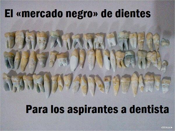 OviDentalGo's tweet photo. España: El «mercado negro» de dientes para los aspirantes a dentista http://t.co/hihHwE1KiI #Odontología http://t.co/cXKfScx36A