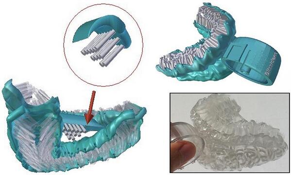 If you want to try the revolutionary dental brush called Blizzident, please write to brenda@aeiou-inc.com
