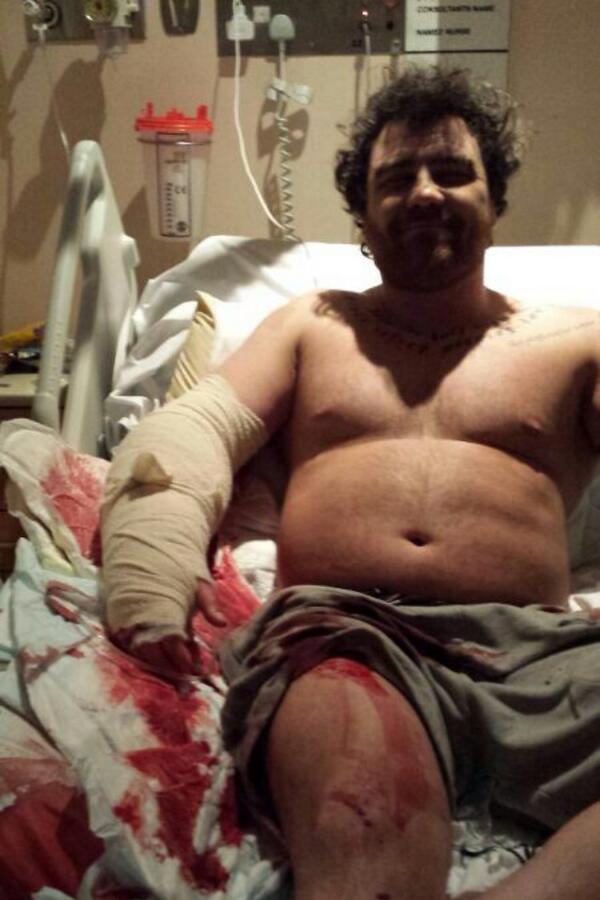 dennypeat's tweet photo. Ricky Bennett looks like it's just legs for bennet for a while http://t.co/PSI0jqO40h