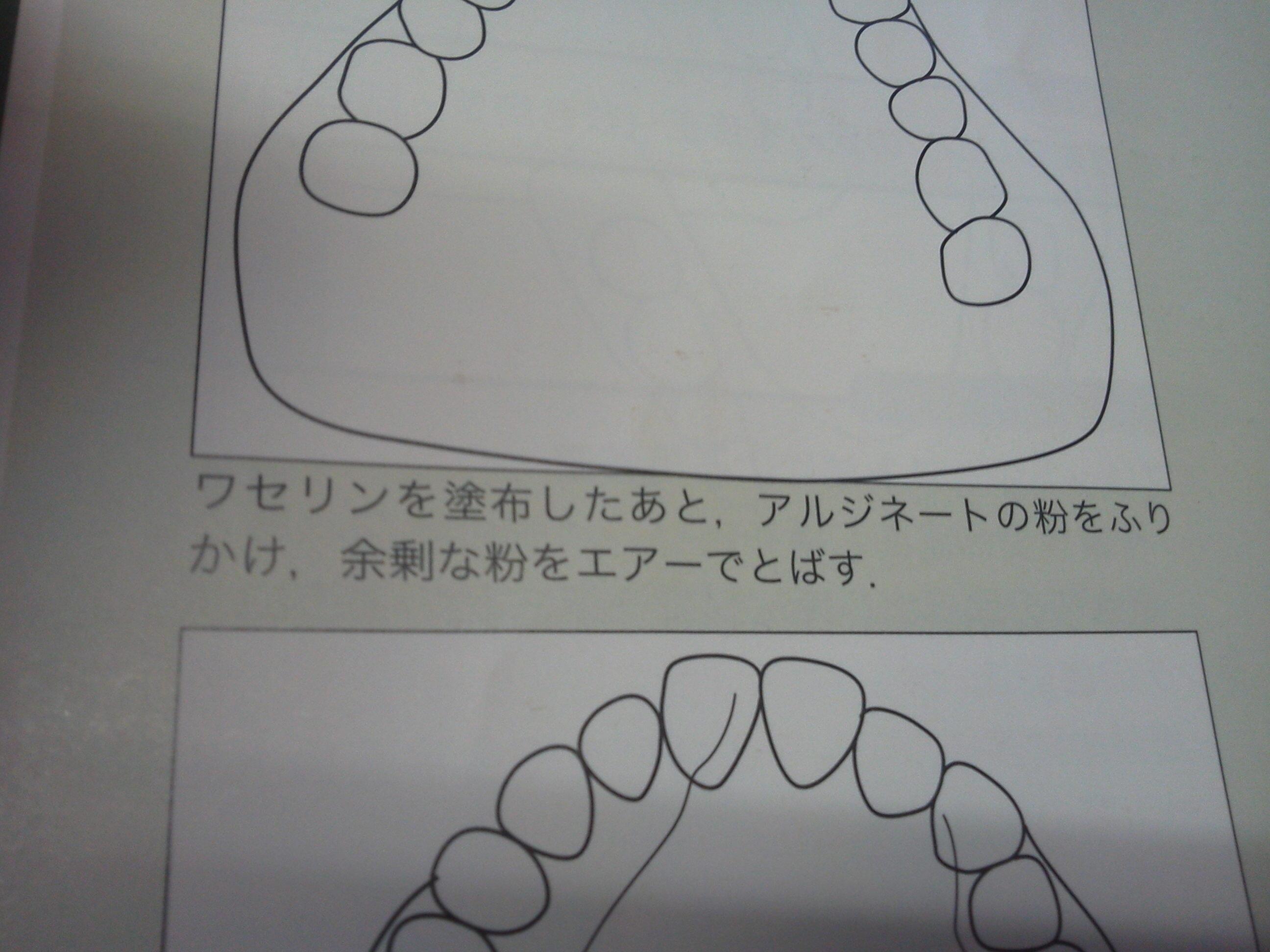 Ds Study これで さ とか か き ら など発音してもらうんですね んで舌が接触した部分の粉がとれてその形をみて 発音状態をみるんですね パラトグラム Http T Co Nxs0uvecvs Twitter