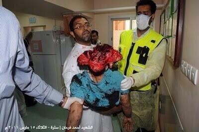BAHRAINDOCTOR's tweet photo. يغضبون من كلمة يسقط حمد وبعض الشعارات التي تطلق للتعبير عن الغضب تجاه ما يقوم به النظام لكن هذه الصور لا تؤثر فيهم http://t.co/pcS6q0jjIG