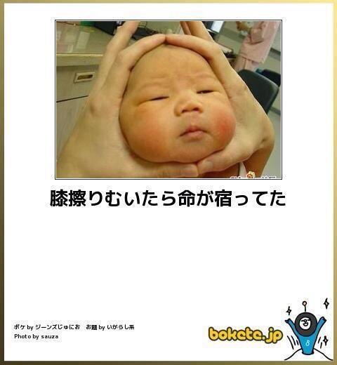 heia4649's tweet photo. 膝擦りむいたら命が宿ってた https://t.co/9KSce9JRvv