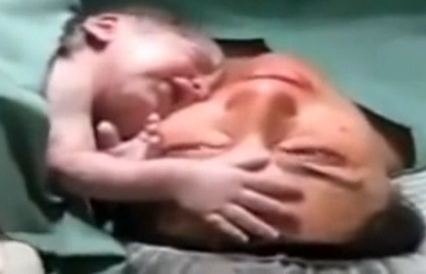 KeciaGaitherMD's tweet photo. "Newborn Baby Won't Let Go of Mother After Birth, Keeps Hugging Her 
http://t.co/nawFHSegI2 http://t.co/yjsdQd4NbI"  Loving this!!