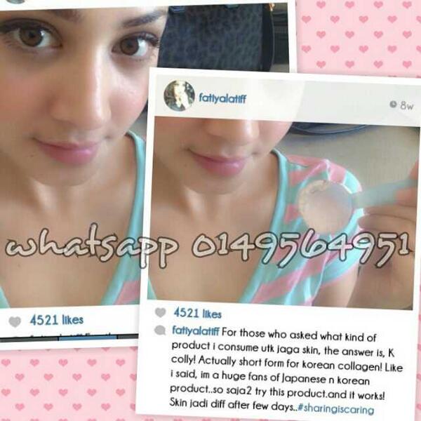 najwamalik_'s tweet image. Mai mai mai. Try K Colly Sweet 17. Only RM120 free postage in SM . add RM10 in SS. 

#WhiteningSupplement #KoreanTech