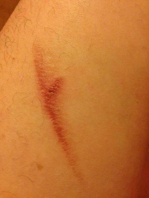 PastryProblems's tweet image. #PastryProblems: