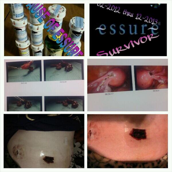 Mom&WifeFightingLupus07 tweet media