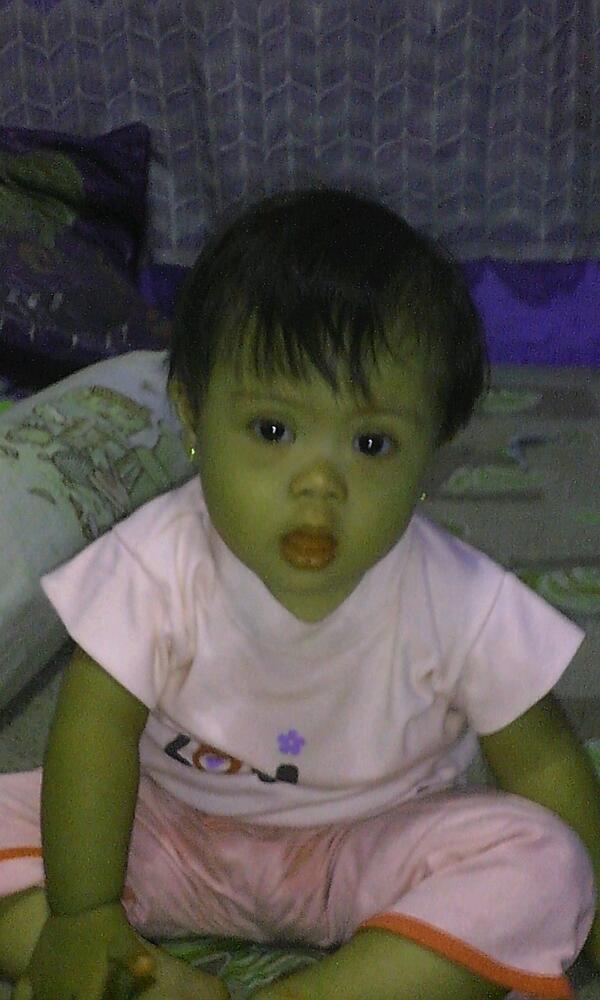 josandre95's tweet photo. GWS my little angel.........big hug...... http://t.co/NiSvko0JPj