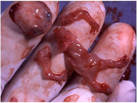 catolicos_es's tweet photo. Cuando defiendas el #aborto haz solo una cosa: mira esta foto. Después intenta seguir defendiéndolo. http://t.co/YnYDOUOlVB