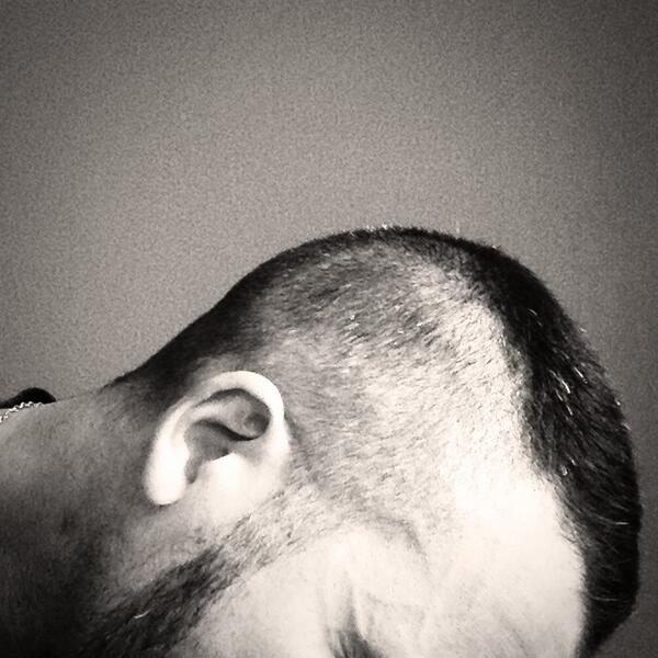 Taglio di capelli a isolotto