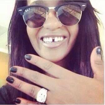“@guccii1017: This Bitch got Engaged but her teeth getting Divorced ” dead 😂😂😂😂😭😭😭