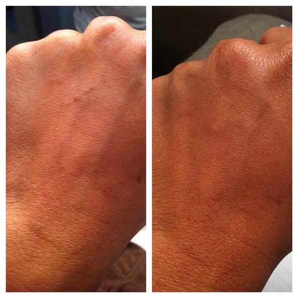 mtjburns's tweet photo. Nerium AD http://t.co/WhasQ0wD5r