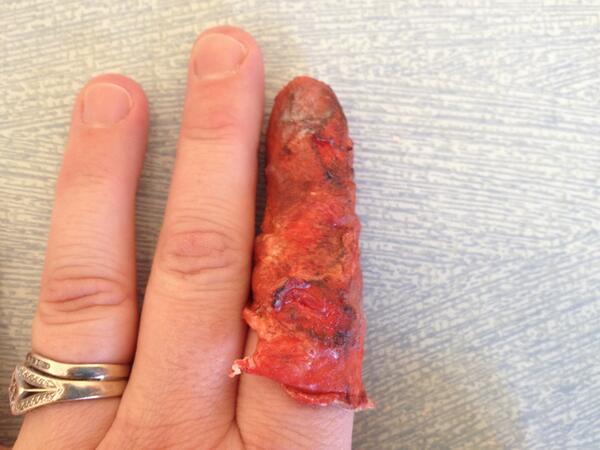 OverUnderColl's tweet image. To start- here's a practice one I made on my finger! #burntsleeve #newplay