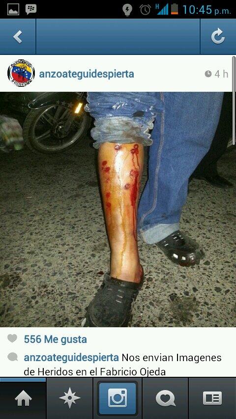 adanjortiz's tweet photo. @fdelrinconCNN heridos desde el fabricio ojoda corriendo para el c.c plaza mayor lecherias anzoategui http://t.co/IcxM0DGBen