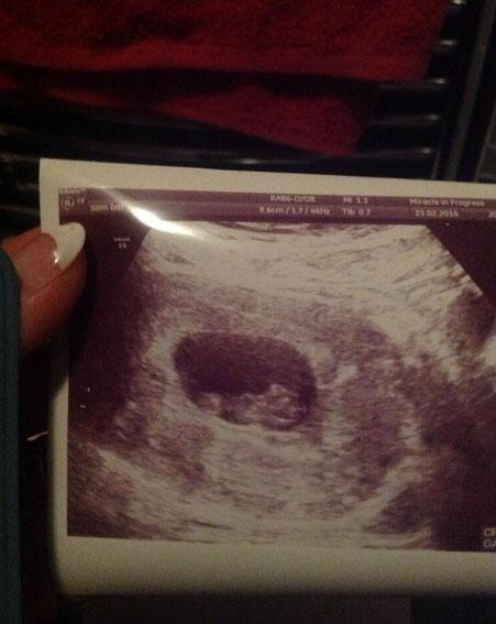 OK_Magazine's tweet photo. X Factor star announces shock pregnancy news. We did not see this coming...http://t.co/ur1PWnHQ8y http://t.co/QdDCP25GRB