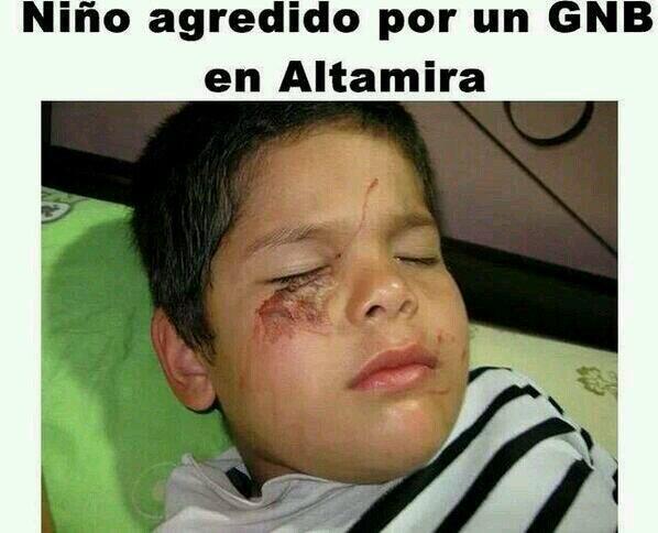 RicardoGuanipa's tweet photo. Este Nino fue atacado por la Policia y Gardia Nacional en Chacao http://t.co/qkOWzMADps