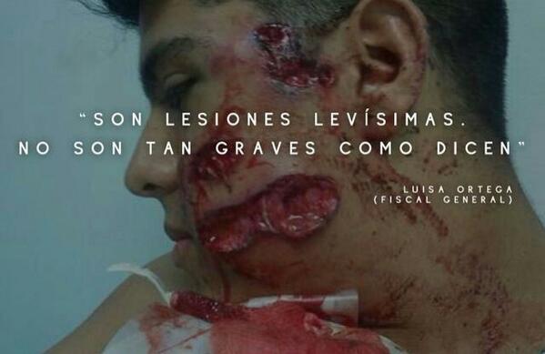 VivaLaUCV's tweet photo. Fiscal @lortegadiaz dice que las lesiones en protestas son leves. #OEAcomplice de esa mentira @OEA_Oficial http://t.co/ruK1983DKK