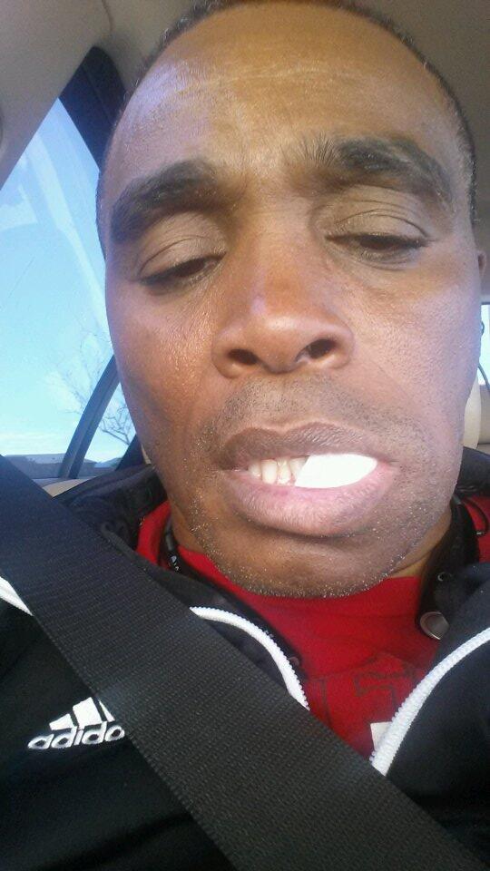 UFCcutman's tweet photo. I'm not going to be in London for ufc. I'd rather be with Ryan Gibson DDS saving my life. The worst tooth infection. http://t.co/yxfy3kZBsp