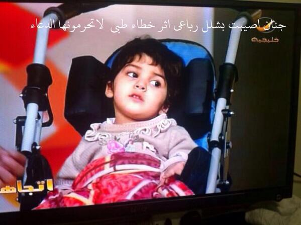 hinfr's tweet photo. @boodyi_10 
طفله محتاج لعلاج مصابه بشلل رباعي اثر خطاء طبي 0555972969 #رتويت http://t.co/rBRArWENNZ