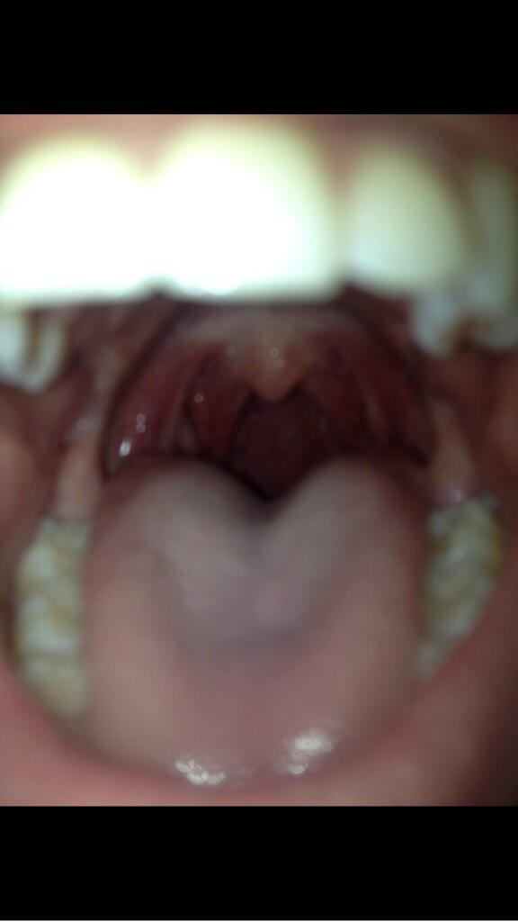 UvulaSHS's tweet photo. Guess the uvula! Hint: it's her birthday http://t.co/7HZRxjtigY