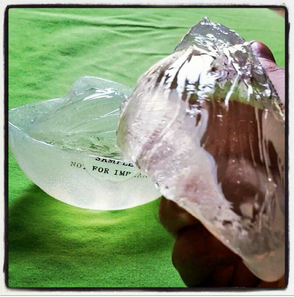 REFINEX's tweet photo. Gel cohesivo en nuestros #implantes mamarios Refinex elimina el riesgo de derrame en caso de rotura. Calidad http://t.co/WBojdXg66o
