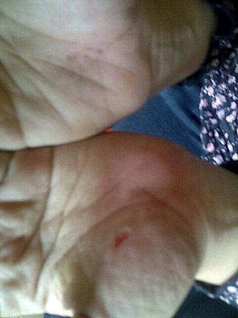 Sepertinyaa ini hadiah ultah.. Jatuh dri motor.. :'(