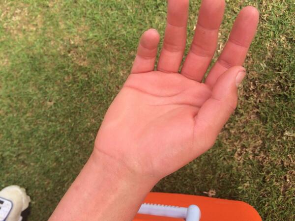 cricketcomau's tweet photo. This is what happens when you try to stop a full-blooded @Gmaxi_32 straight-drive #ouch #SAvsAUS http://t.co/fG73mHHs0e