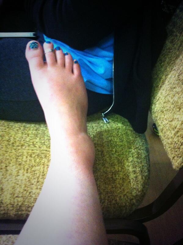 stuart_paige8's tweet image. We'll prob gunna be see the bench for awhile #vbprobs