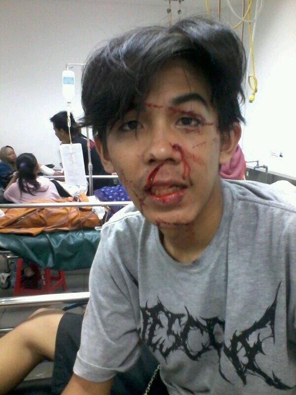 Semoga cepat sembuh &amp; bisa meliar lagi @BOSSFIKAR :D