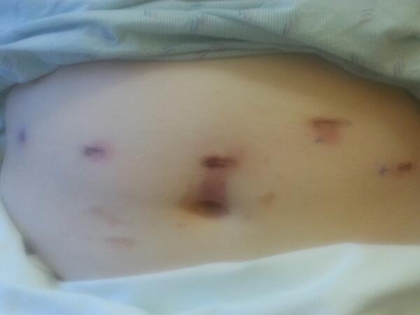 mslyson's tweet image. Surgery #robotstyle