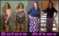 web2rule's tweet photo. Before/after gastric http://t.co/SOx8DGdMRY