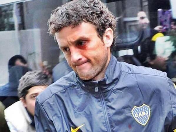 EDGAR_M_87's tweet photo. @gustavohIopez  esta es la foto de la cara de ledesma http://t.co/dFdSsL5dNt