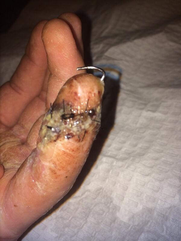 LarkinKurtis's tweet photo. For sale one pinky finger minor damage may accept trades no junk please http://t.co/eA1FQzhWXF