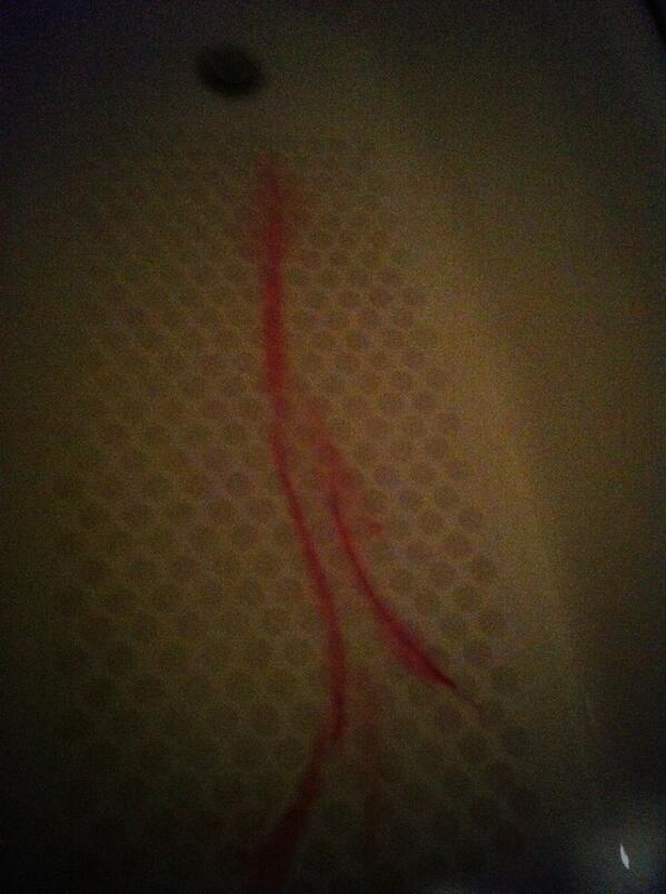 katemallon97's tweet photo. #makeYouBleed http://t.co/hn5sHI335e