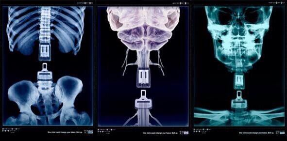 StaffsRoadHarm tweet picture