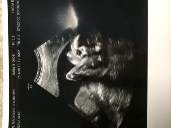 BrubakerJesse's tweet photo. Just chillin in da womb doe!!! http://t.co/t9kpY7rJGc