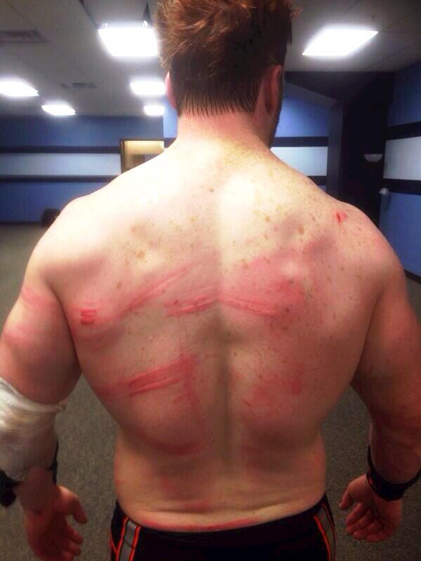 Photo of Sheamus Following Raw Street Fight BiaiFbTIIAAEOGJ