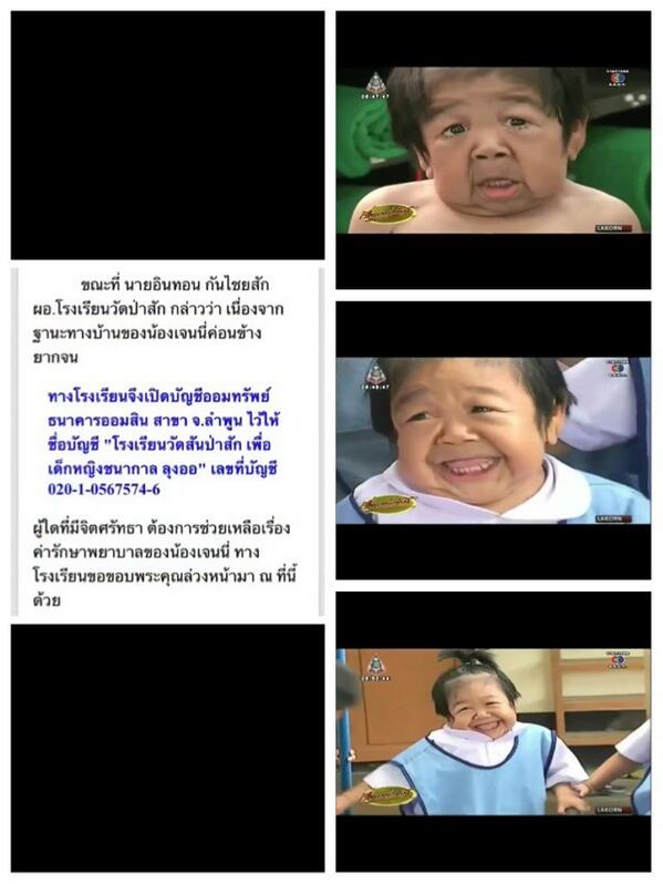 น้องเจนนี่ อายุ4ขวบ ป่วยเป็นโรคหน้าแก่ สงสารน้องอ่ะ แต่ชอบรอยยิ้มน้องมาก ใครอยากช่วยน้องก็ช่วยRtหน่อยนะ🙏