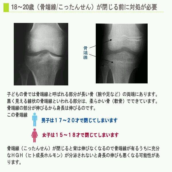 管理栄養士 国家試験 虎の巻bot على تويتر 成長ホルモンの過剰分泌 骨端線の閉鎖前に起こると 身長が異常に伸びる巨人症となる 骨端線の閉鎖後に起こると 手足や顔の一部などの末端が肥大する先端肥大症となる Http T Co It9xycyvbs