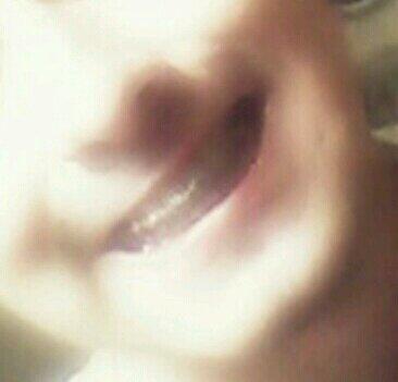 lucktabo's tweet photo. Creo yo que ya falta poco gracias a my doc! @DrPeterValverde #ortodoncia #elmejor #guayaquil #sonrisa #brackets http://t.co/BEaNgZtmHY